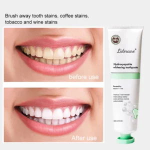 Nano Hydroxyapatite Toothpaste (4)