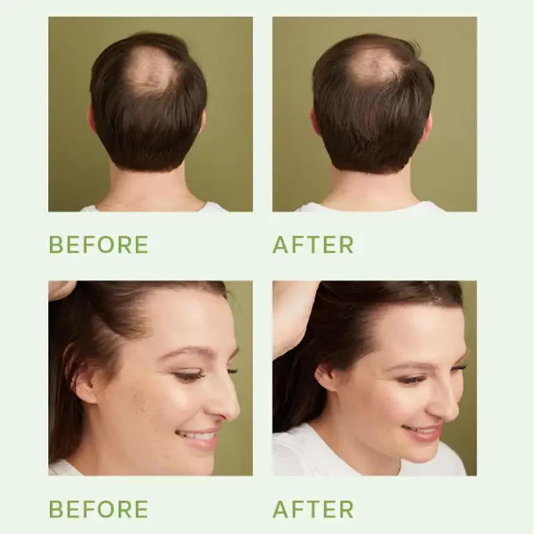 Hair Scalp Serum (2)